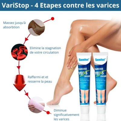 VariStop: Dites Adieu aux Varices