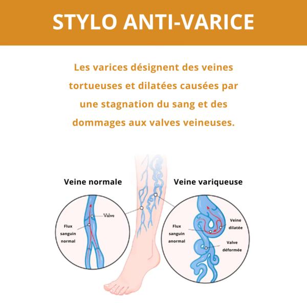Stylo anti-varice Stylo anti-varice
